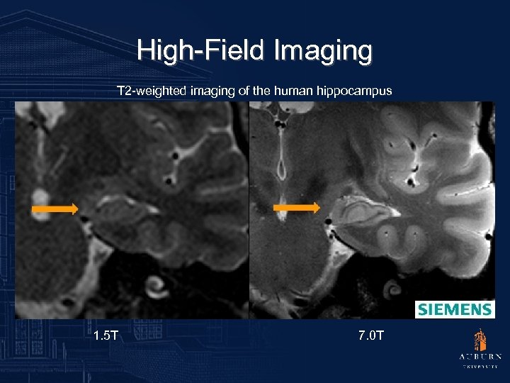 High-Field Imaging T 2 -weighted imaging of the human hippocampus 1. 5 T 7.