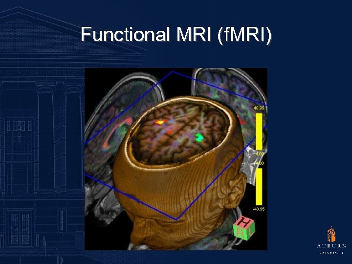 Functional MRI (f. MRI) 