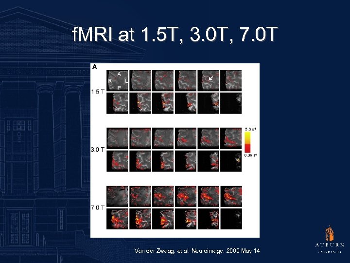 f. MRI at 1. 5 T, 3. 0 T, 7. 0 T Van der