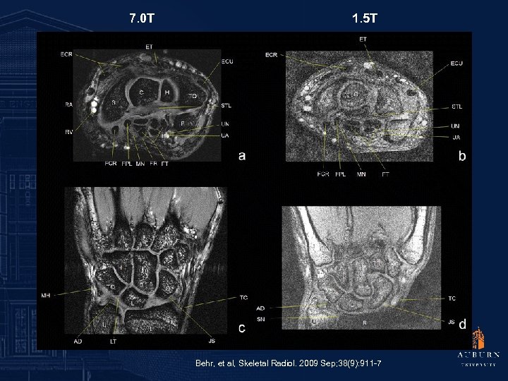 7. 0 T 1. 5 T Behr, et al, Skeletal Radiol. 2009 Sep; 38(9):