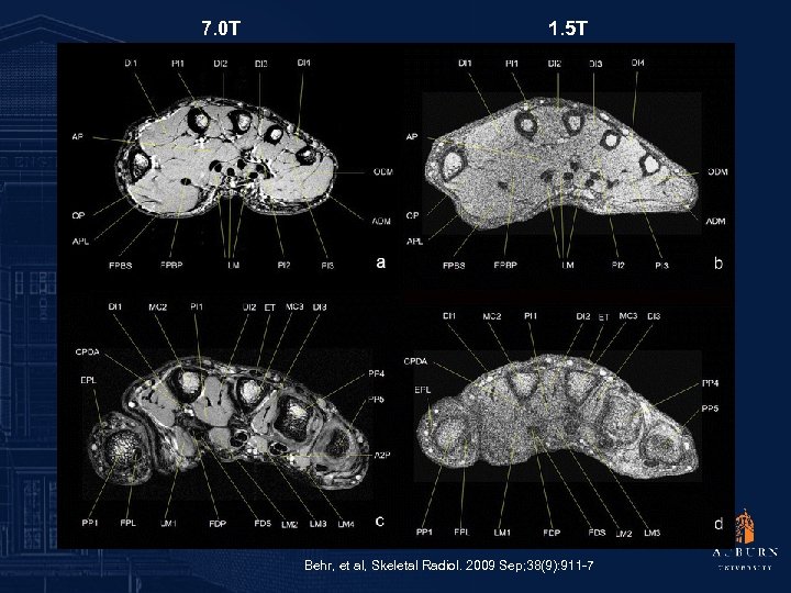 7. 0 T 1. 5 T Behr, et al, Skeletal Radiol. 2009 Sep; 38(9):