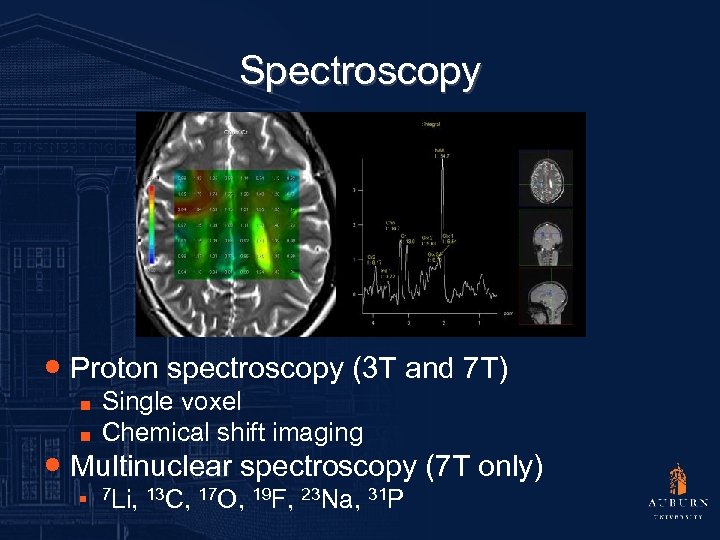 Spectroscopy ● Proton spectroscopy (3 T and 7 T) ■ ■ Single voxel Chemical