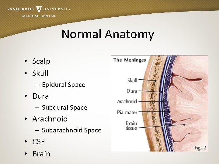 Normal Anatomy • Scalp • Skull – Epidural Space • Dura – Subdural Space