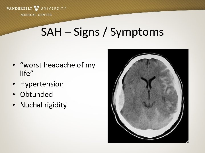 SAH – Signs / Symptoms • “worst headache of my life” • Hypertension •