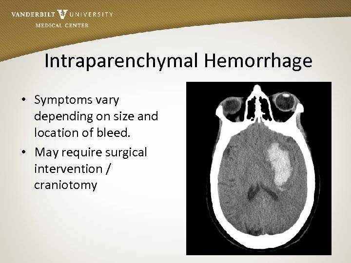 Intraparenchymal Hemorrhage • Symptoms vary depending on size and location of bleed. • May