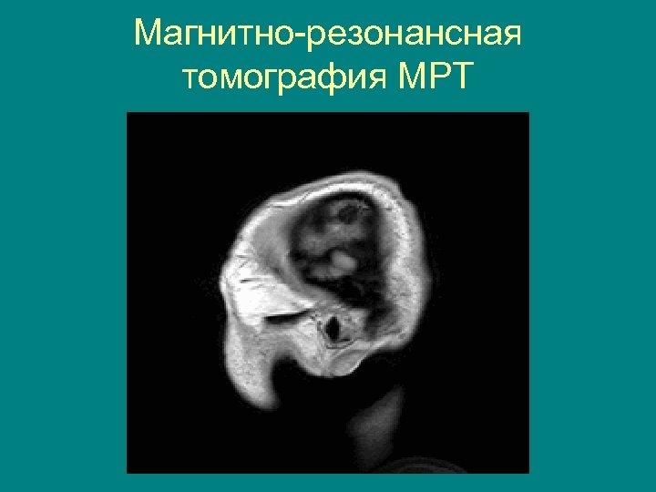 Магнитно-резонансная томография МРТ 