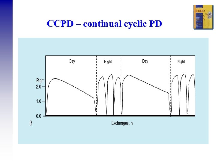 CCPD – continual cyclic PD 
