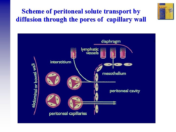 Scheme of peritoneal solute transport by diffusion through the pores of capillary wall 