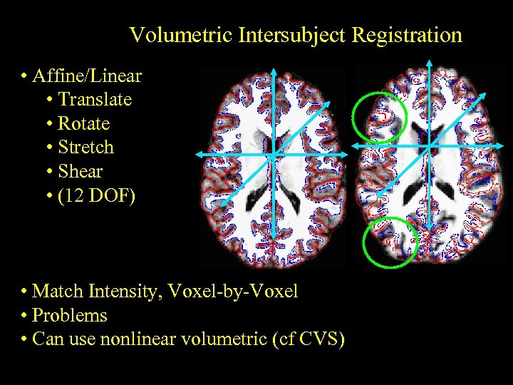 Volumetric Intersubject Registration • Affine/Linear • Translate • Rotate • Stretch • Shear •