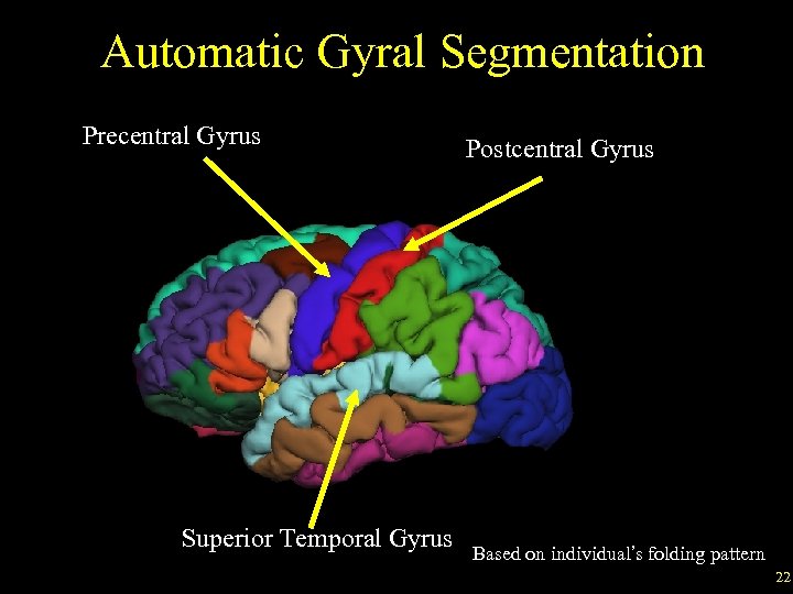 Automatic Gyral Segmentation Precentral Gyrus Superior Temporal Gyrus Postcentral Gyrus Based on individual’s folding