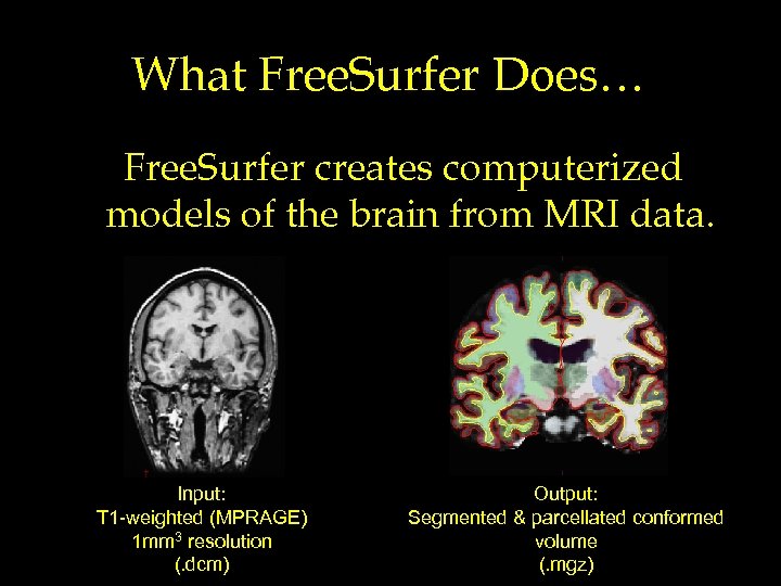 What Free. Surfer Does… Free. Surfer creates computerized models of the brain from MRI