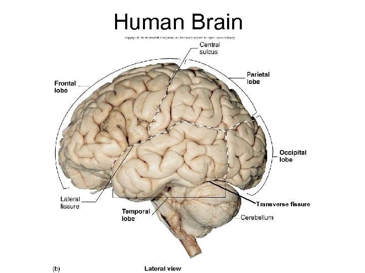 Human Brain Transverse fissure 