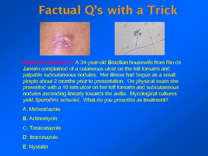 Factual Q’s with a Trick Example Question 2 A 34 -year-old Brazilian housewife from