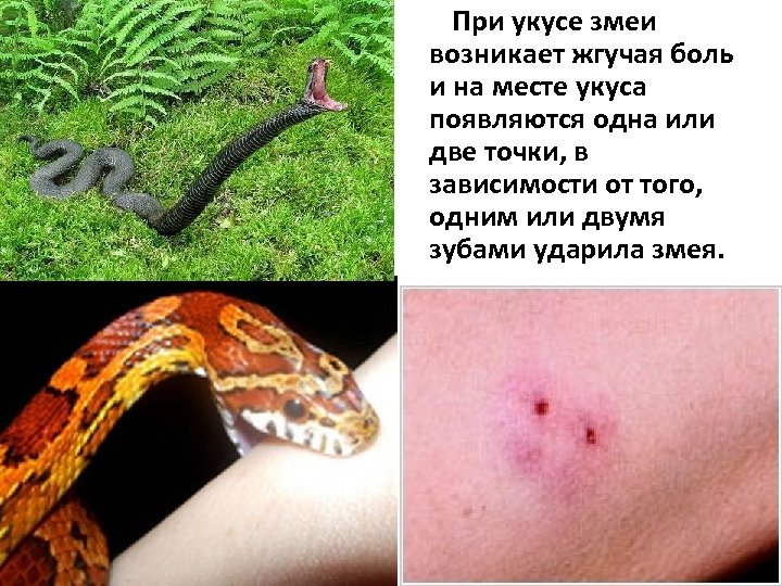 При укусе змеи возникает жгучая боль и на месте укуса появляются одна или две