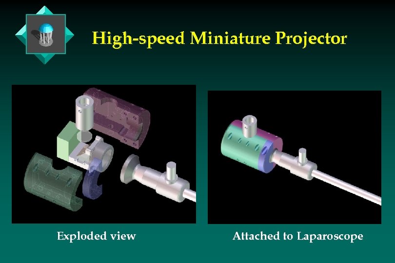 High-speed Miniature Projector Exploded view Attached to Laparoscope 