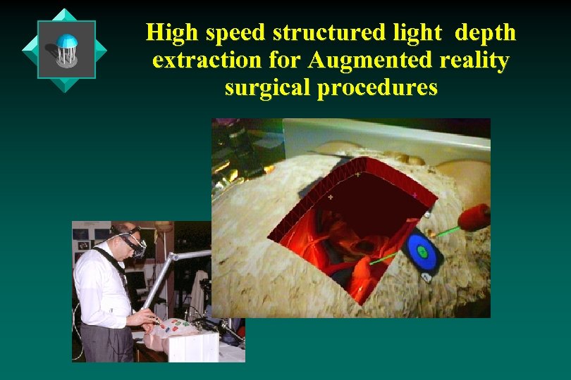 High speed structured light depth extraction for Augmented reality surgical procedures 