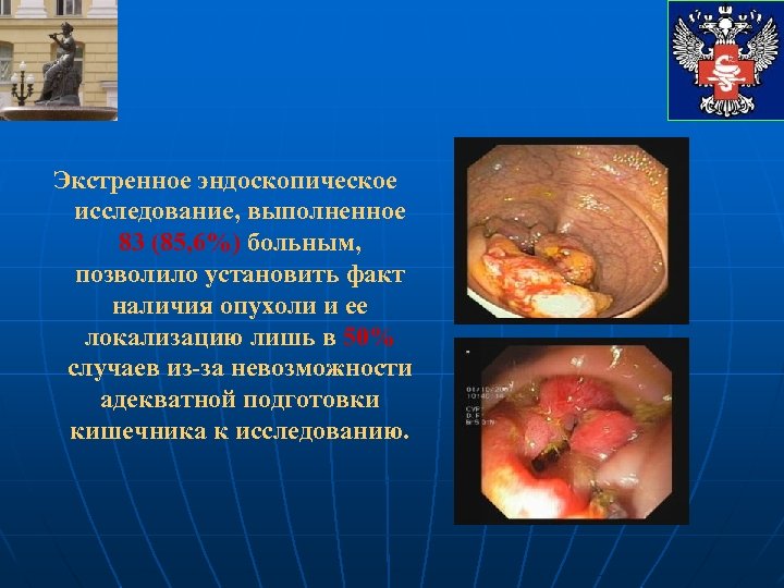 Экстренное эндоскопическое исследование, выполненное 83 (85, 6%) больным, позволило установить факт наличия опухоли и