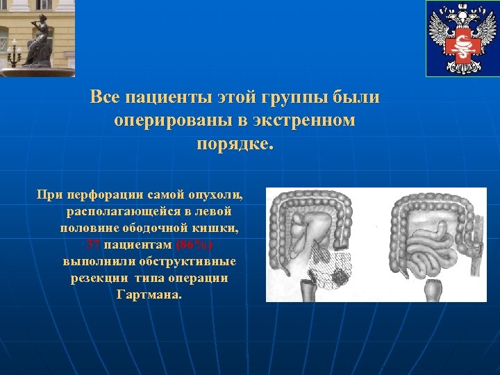 Все пациенты этой группы были оперированы в экстренном порядке. При перфорации самой опухоли, располагающейся