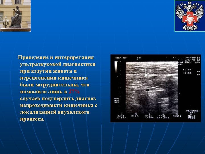 Проведение и интерпретация ультразвуковой диагностики при вздутии живота и переполнении кишечника были затруднительны, что