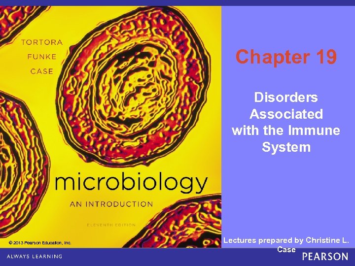 Chapter 19 Disorders Associated with the Immune System © 2013 Pearson Education, Inc. Lectures