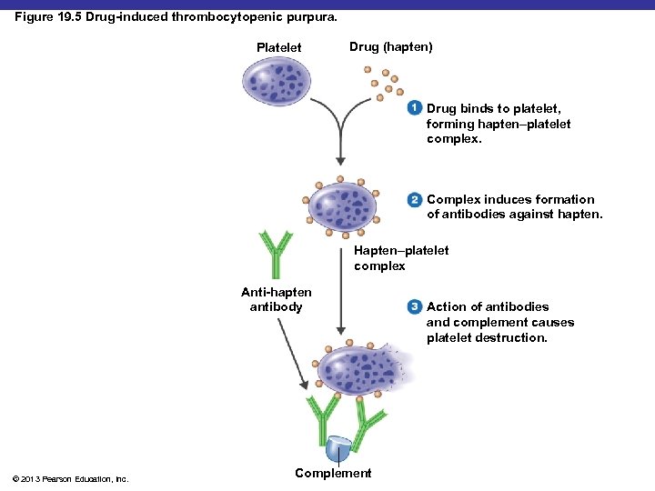 Figure 19. 5 Drug-induced thrombocytopenic purpura. Platelet Drug (hapten) Drug binds to platelet, forming
