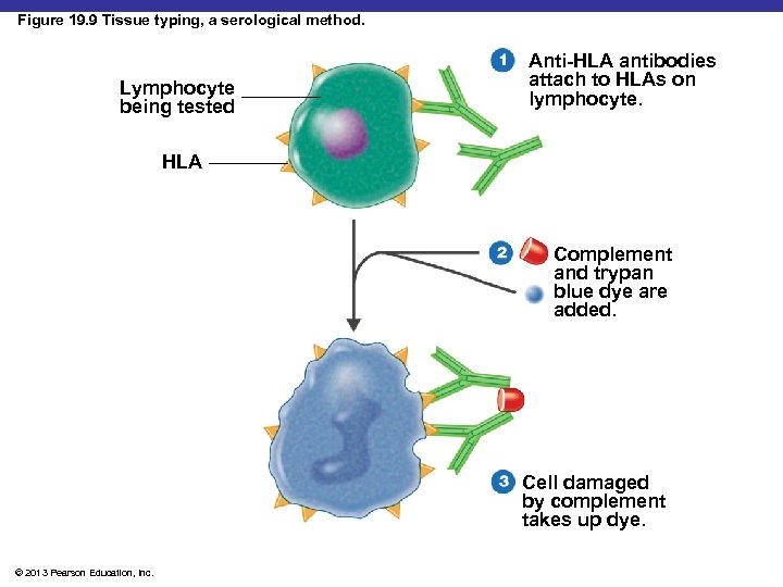 Figure 19. 9 Tissue typing, a serological method. Lymphocyte being tested Anti-HLA antibodies attach