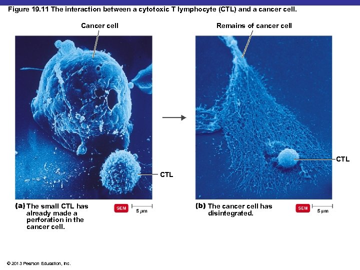 Figure 19. 11 The interaction between a cytotoxic T lymphocyte (CTL) and a cancer