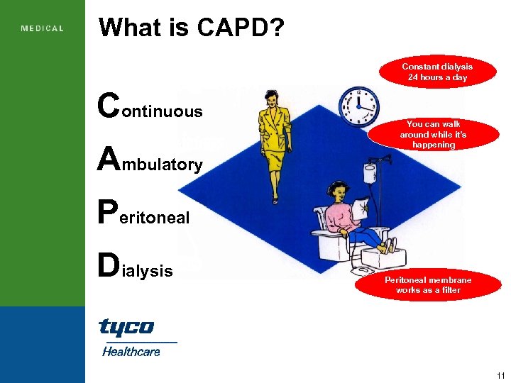What is CAPD? Constant dialysis 24 hours a day Continuous Ambulatory You can walk