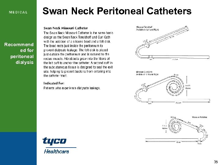 Swan Neck Peritoneal Catheters Recommend ed for peritoneal dialysis 35 