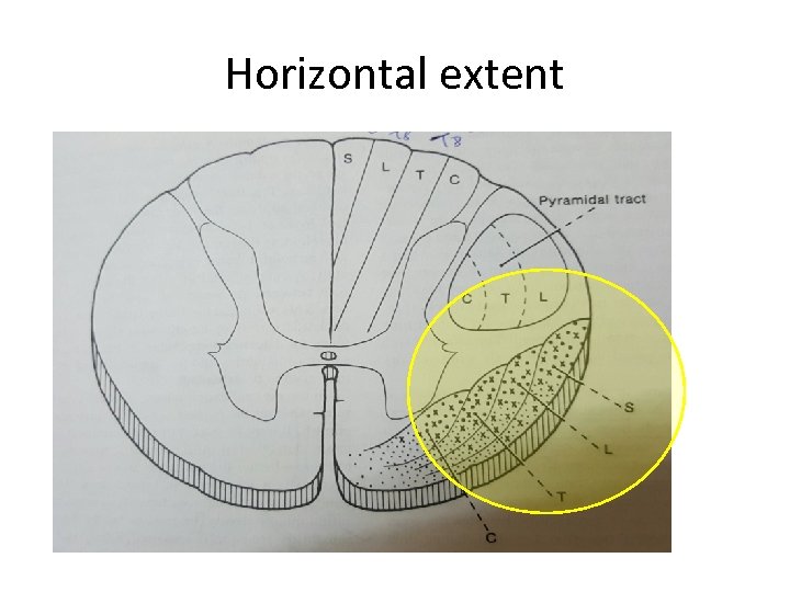 Horizontal extent 