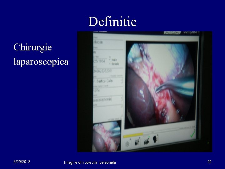 Definitie Chirurgie laparoscopica 5/29/2013 Imagine din colectia personala 20 