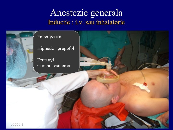 Anestezie generala Inductie : i. v. sau inhalatorie Preoxigenare Hipnotic : propofol Fentanyl Curara