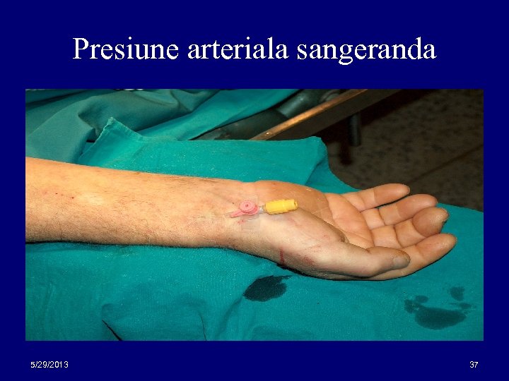 Presiune arteriala sangeranda 5/29/2013 37 