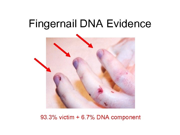 Fingernail DNA Evidence 93. 3% victim + 6. 7% DNA component 