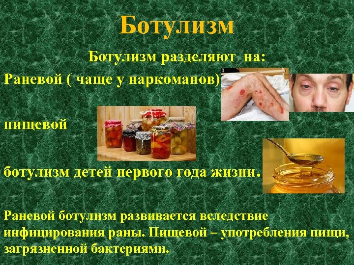 Возбудитель ботулизма фото