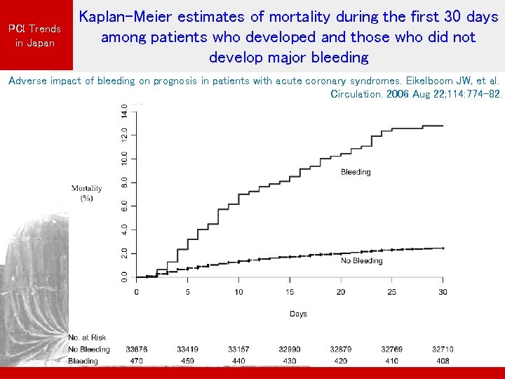 PCI Trends in Japan Kaplan-Meier estimates of mortality during the first 30 days among