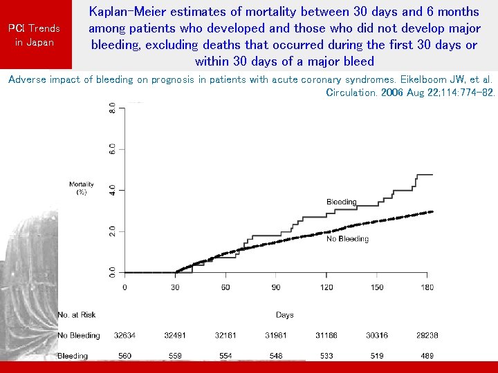 PCI Trends in Japan Kaplan-Meier estimates of mortality between 30 days and 6 months