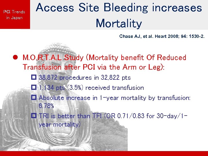 PCI Trends in Japan Access Site Bleeding increases Mortality Chase AJ, et al. Heart
