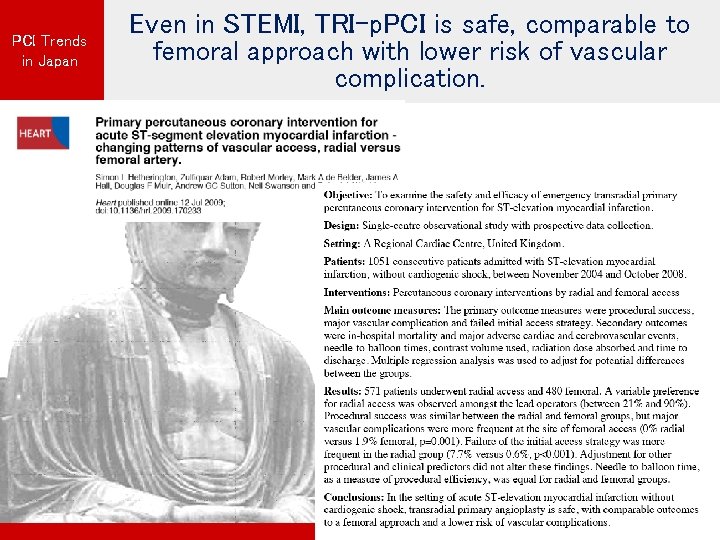 PCI Trends in Japan Even in STEMI, TRI-p. PCI is safe, comparable to femoral