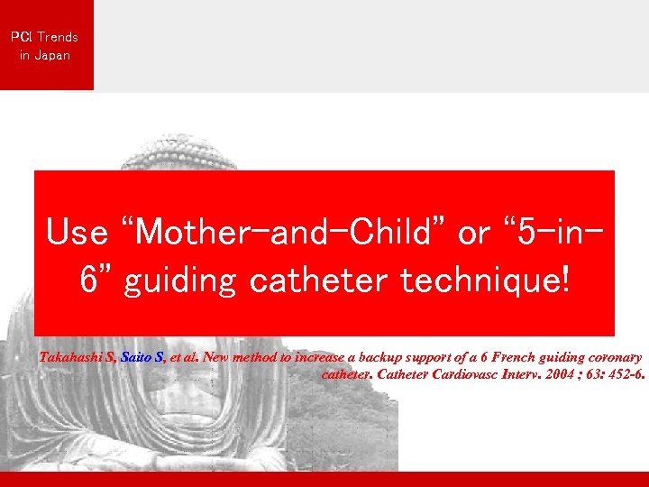 PCI Trends in Japan Use “Mother-and-Child” or “ 5 -in 6” guiding catheter technique!