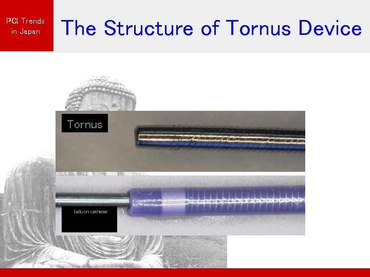 PCI Trends in Japan The Structure of Tornus Device Tornus 　balloon catheter 