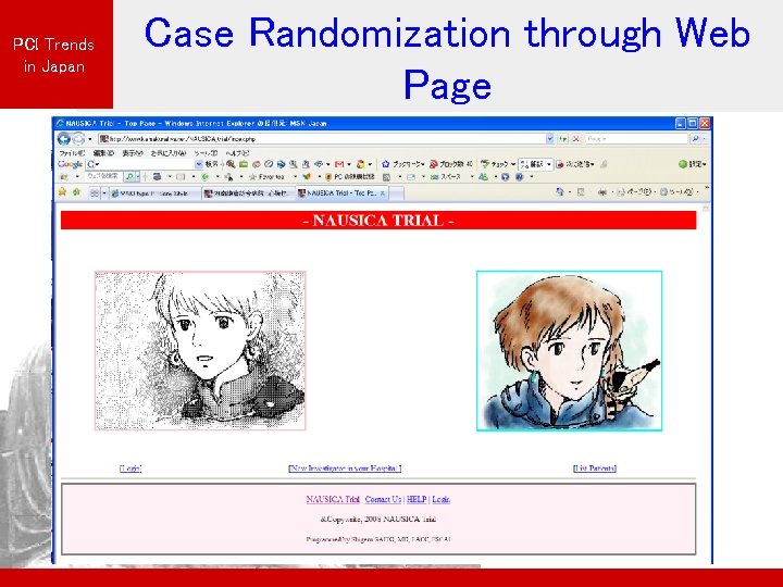 PCI Trends in Japan Case Randomization through Web Page 