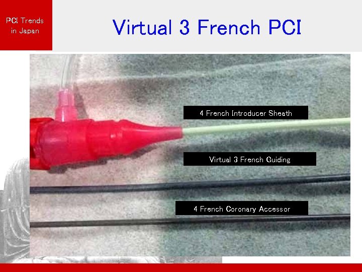 PCI Trends in Japan Virtual 3 French PCI 4 French Introducer Sheath Virtual 3