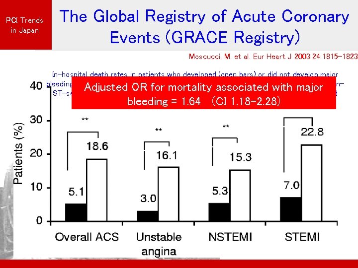 PCI Trends in Japan The Global Registry of Acute Coronary Events (GRACE Registry) Moscucci,