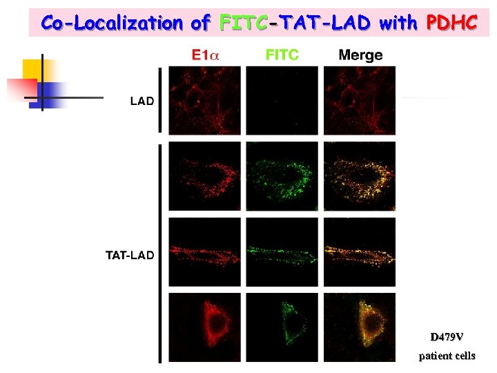 Co-Localization of FITC-TAT-LAD with PDHC D 479 V patient cells 