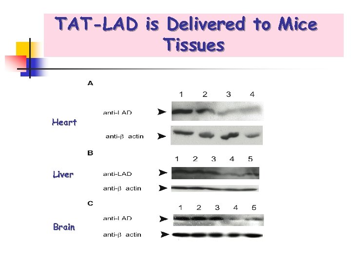 TAT-LAD is Delivered to Mice Tissues Heart Liver Brain 