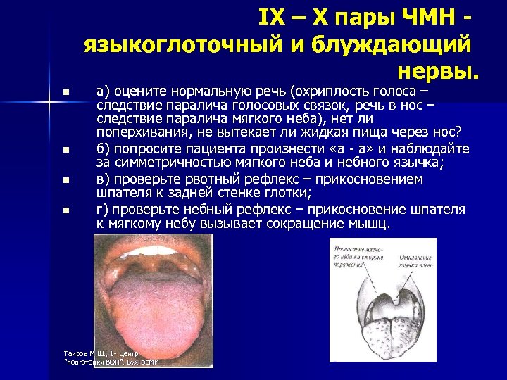 IX – X пары ЧМН языкоглоточный и блуждающий нервы. n n а) оцените нормальную