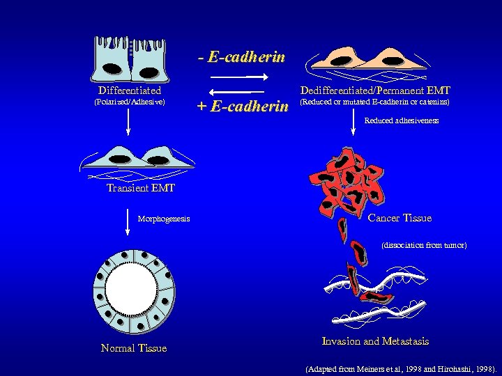 - E-cadherin Differentiated (Polarized/Adhesive) Dedifferentiated/Permanent EMT + E-cadherin (Reduced or mutated E-cadherin or catenins)