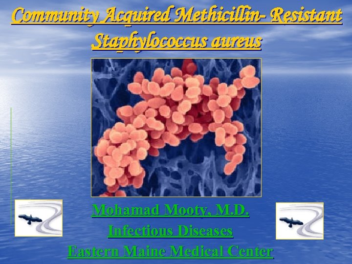 Community Acquired Methicillin- Resistant Staphylococcus aureus Mohamad Mooty, M. D. Infectious Diseases Eastern Maine