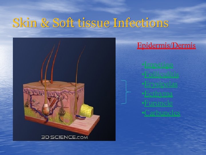 Skin & Soft tissue Infections Epidermis/Dermis • Impetigo • Folliculitis • Erysipelas • Ecthyma